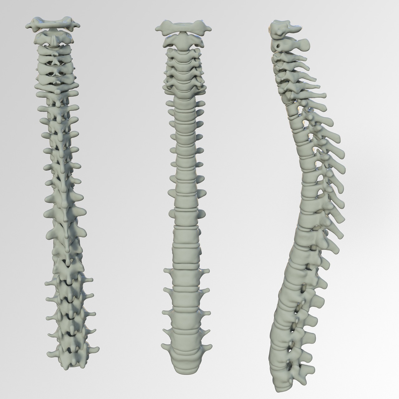 spine, bone, back pain